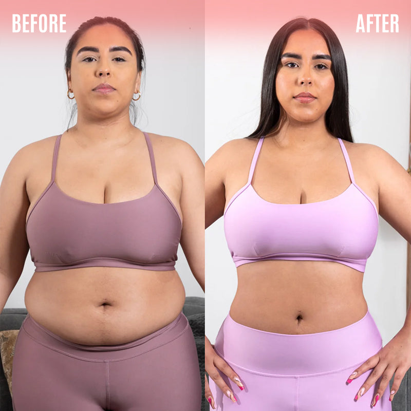 I was fed up of spending money on professional treatments. Three months ago I decided to try MiaBody and I'm so glad I did. I noticed results after the first month and this is me now! My stomach is much more firm. The before picture doesn't even feel like me anymore.